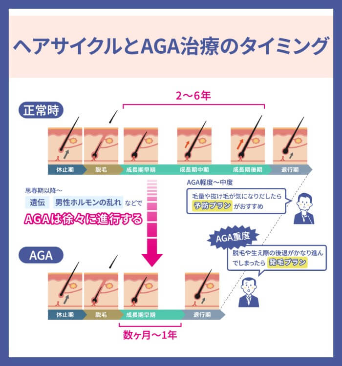 AGA治療のタイミングとヘアサイクル